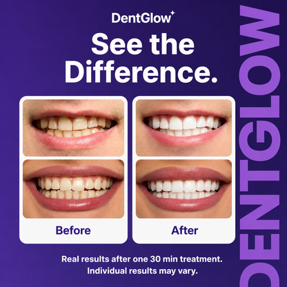DentGlow™ Purple Whitening Strips – Peroxide-Free, No Sensitivity